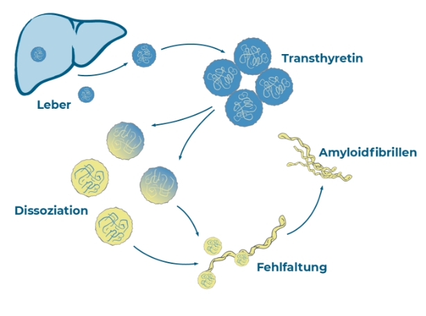Transthyretin-Amyloidose verstehen
